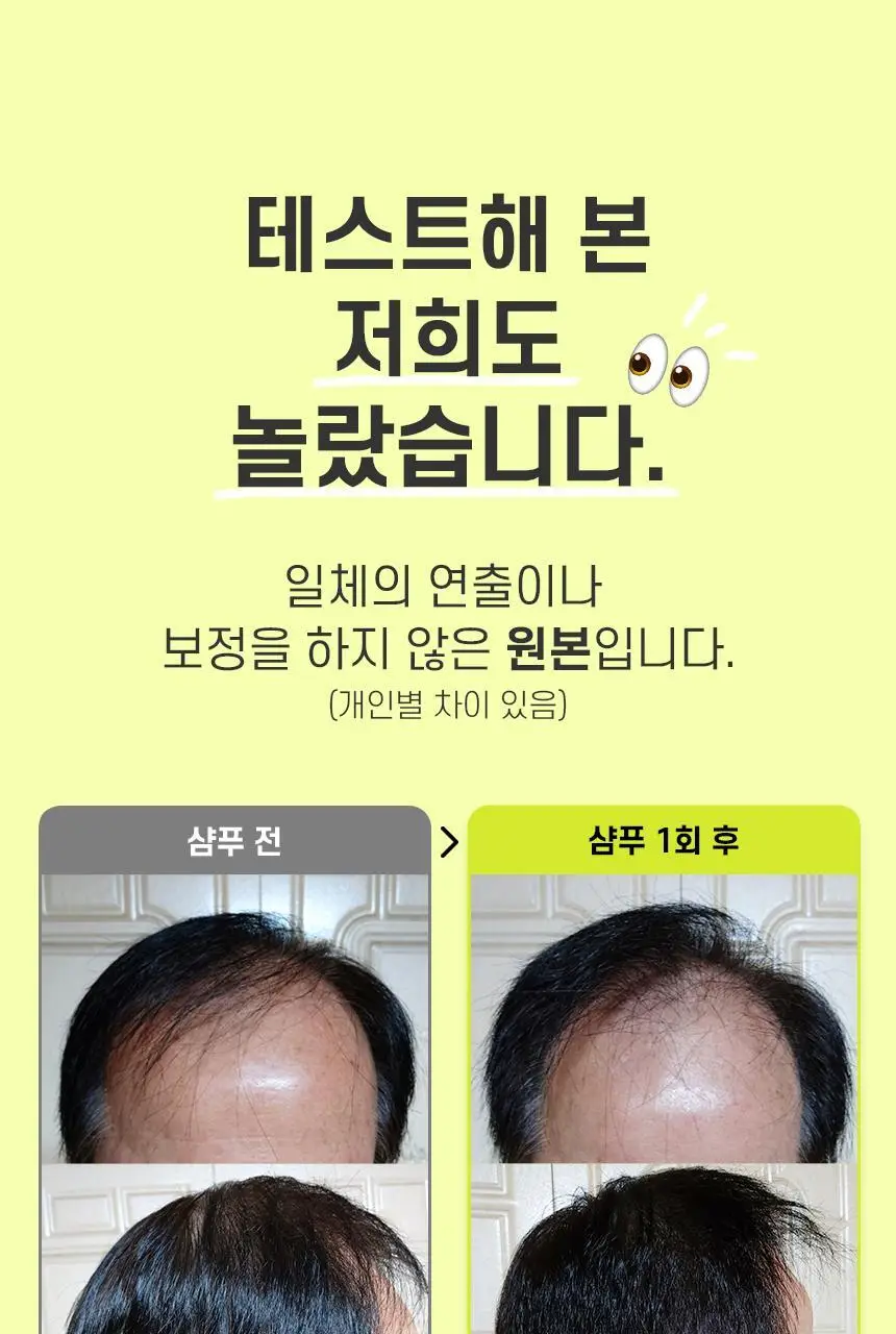 [카이스트특허기술] 그래비티 헤어리프팅 샴푸 엑스트라스트롱 475ml+475ml 리필 기획(+30ml 2개 증정) 상세페이지 6